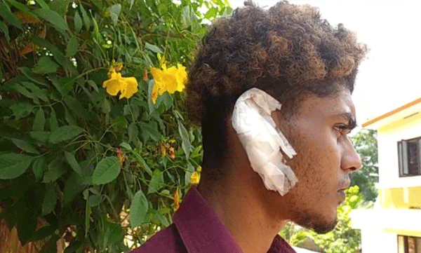 യുവാവിനെ ആക്രമിച്ച് ചെവി കടിച്ചു പറിച്ചതായി പരാതി