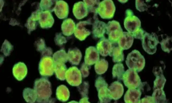 അമീബിക് മസ്തിഷ്കജ്വരമെന്ന സംശയത്തിൽ നിരീക്ഷണത്തിനായി പ്രവേശിപ്പിച്ച കുട്ടികളുടെ പരിശോധന ഫലം നെഗറ്റീവ്