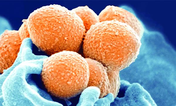 കോവിഡിനു പിന്നാലെ മറ്റൊരു മഹാമാരിയുടെ പിടിയിലാകുമോ ലോകമെന്ന ആശങ്കയില്‍ ശാസ്ത്രലോകം ; ജപ്പാനില്‍നിന്നുള്ള സ്‌ട്രെപ്‌ടോകോക്കല്‍ ടോസിക് ഷോക്ക് സിന്‍ഡ്രോം ആശങ്കയാകുന്നു