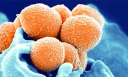 കോവിഡിനു പിന്നാലെ മറ്റൊരു മഹാമാരിയുടെ പിടിയിലാകുമോ ലോകമെന്ന ആശങ്കയില്‍ ശാസ്ത്രലോകം ; ജപ്പാനില്‍നിന്നുള്ള സ്‌ട്രെപ്‌ടോകോക്കല്‍ ടോസിക് ഷോക്ക് സിന്‍ഡ്രോം ആശങ്കയാകുന്നു