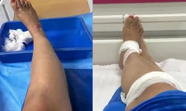 ഒരിക്കലും ഇനി റാപ്പിഡോ എടുക്കില്ല: ബംഗളൂരുവിലെ ദുരനുഭവം പങ്കുവച്ച് യുവതി 
