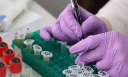 ചാന്ദിപുര വൈറസ് ബാധ; 22 കുട്ടികള്‍ക്ക് വൈറസ് സ്ഥിരീകരിച്ചു, ചികിത്സയിലുള്ളത് 117 പേര്‍
