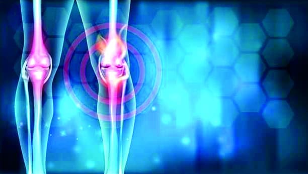 The causes of secondary arthritis are many