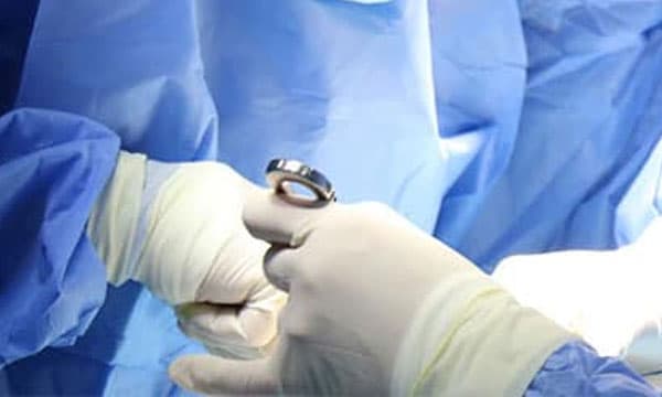 പ്രസവശേഷവും യുവതിക്കു കലശലായ വയറുവേദന ; പരിശോധനയില്‍ വയറിനുള്ളില്‍ കത്രിക ; ഹരിപ്പാട് താലൂക്കാശുപത്രിയില്‍ നടത്തിയ ശസ്ത്രക്രിയയില്‍ വയറ്റില്‍ രക്തവും മാലിന്യങ്ങളും 