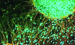 ജപ്പാനിലെ ഗവേഷകര്‍ മൂലകോശ ചികിത്സ വികസിപ്പിച്ചെടുത്തു ; സുഷുമ്‌നാ നാഡി ക്ഷതം മൂലം ശരീരം തളര്‍ന്നയാള്‍ എഴുന്നേറ്റു നടന്നു