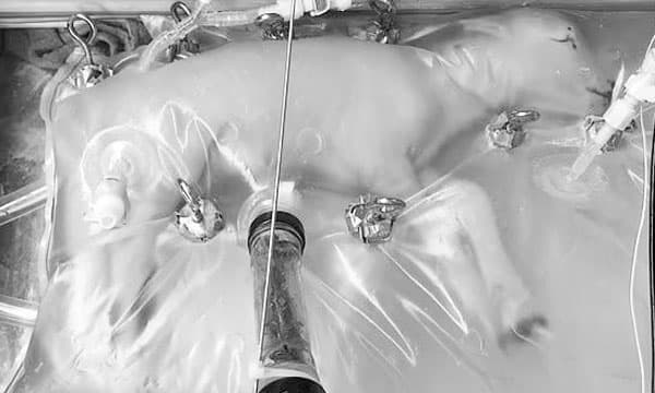 വൈദ്യശാസ്ത്രത്തില്‍ വിപ്ലവം സൃഷ്ടിക്കാന്‍ ബോഡിയോയ്ഡുകള്‍ ; തലച്ചോറില്ലാത്ത മനുഷ്യശരീരങ്ങള്‍ സൃഷ്ടിച്ചു വളര്‍ത്താന്‍ ശാസ്ത്രജ്ഞര്‍