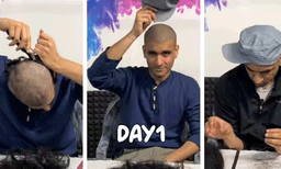 അമ്പമ്പോ അത്ഭുതം തന്നെ! തല മൊട്ടയടിച്ച് ശേഷം മുടിയിഴകള്‍ എണ്ണിതിട്ടപ്പെടുത്തുന്ന യുവാവ്
