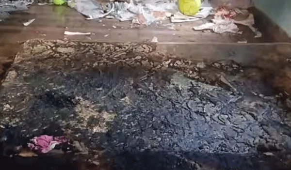 കരുനാ​ഗപ്പള്ളിയിൽ മക്കളെ തീ കൊളുത്തി ആത്മഹത്യക്ക് ശ്രമിച്ച അമ്മ മരിച്ചു; 2 മക്കൾ ചികിത്സയിൽ