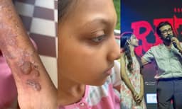 ‘‘ഷൂട്ടിനിടെ അവളുടെ കണ്ണുകള്‍, പുരികങ്ങൾ, മുടി, ചെവികൾ, കൈകൾ എന്നിവയ്ക്ക് തീപിടിച്ചു; മടങ്ങാന്‍ നിര്‍ദ്ദേശിച്ചപ്പോള്‍ അവള്‍ ധൈര്യപൂര്‍വ്വം രംഗം പൂര്‍ത്തിയാക്കി...’’ അഞ്ജലി നായര്‍