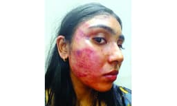 നിയമനടപടിയുമായി മുമ്പോട്ട് പോകും ; ഒത്തുതീര്‍പ്പിനില്ലെന്ന് സീനിയര്‍ അഭിഭാഷനെതിരേ ശ്യാമിലി