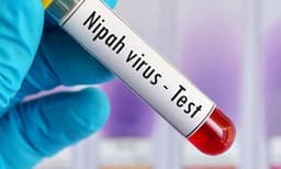 ലക്ഷണങ്ങളോടെ ആശുപത്രിയില്‍ പ്രവേശിപ്പിച്ച പാലക്കാടുകാരിക്ക് നിപ സ്ഥിരീകരിച്ചു