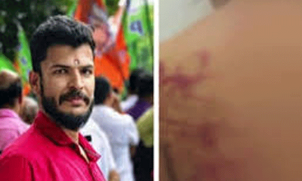 പങ്കാളിയെ മർദിച്ചെന്ന പരാതിയിൽ യുവമോർച്ച നേതാവ് കസ്റ്റഡിയിൽ