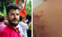  പങ്കാളിയെ മർദിച്ചെന്ന പരാതിയിൽ യുവമോർച്ച നേതാവ് കസ്റ്റഡിയിൽ