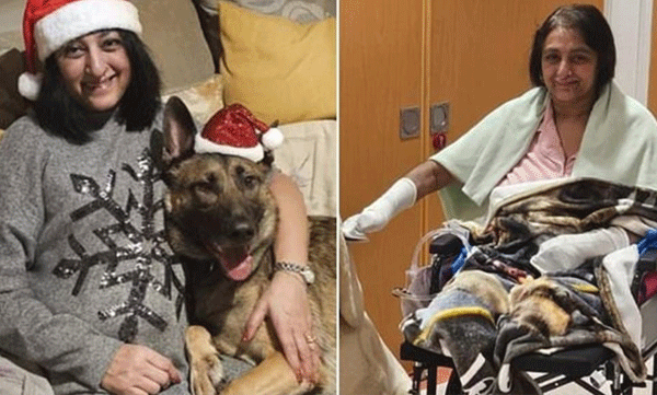 വളര്‍ത്തുനായ മുറിവില്‍ നക്കി, പക്ഷേ 56 കാരിക്ക് നഷ്ടമായത് കൈകാലുകള്‍, നടുങ്ങി സോഷ്യല്‍ മീഡിയ
