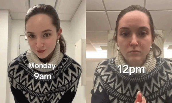 ഓഫീസിലെ അന്തരീക്ഷം ശരീരത്തെയും മുടിയെയും ബാധിക്കുന്നു: വീഡിയോയുമായി യുവതി 
