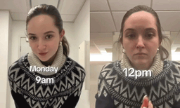 ഓഫീസിലെ അന്തരീക്ഷം ശരീരത്തെയും മുടിയെയും ബാധിക്കുന്നു: വീഡിയോയുമായി യുവതി 
