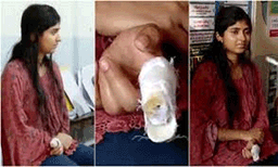 ഇടതുകയ്യിലെ ചൂണ്ടുവിരലിൽ ശസ്ത്രക്രിയ കഴിഞ്ഞതിന്‍റെ കെട്ടുമായെത്തി, വോട്ടിടാൻ പറ്റില്ലെന്ന് ഉദ്യോഗസ്ഥർ; 5 മണിക്കൂർ പ്രതിഷേധം  ഒടുവിൽ അക്ഷര വോട്ടിട്ടു