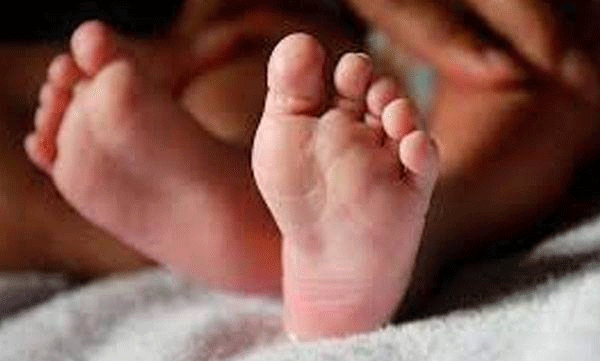 photo; representative image