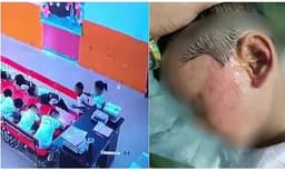 തല ഉയർത്തിയതിന് സഹപാഠിയെ  മോണിറ്റർ ക്രൂരമായി മർദ്ദിച്ചു; നഴ്സറി ക്ലാസിലെ ക്രൂരത!