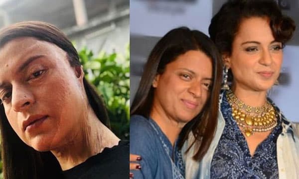 ആദ്യമായി ആസിഡ് ഒഴിച്ച ആളുടെ പേരും, കാരണവും വെളിപ്പെടുത്തി കങ്കണയുടെ സഹോദരി
