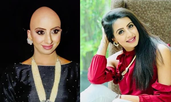 Sanjana Galrani donate her hair (Image Source: Instagram)