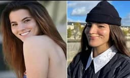 മോഡലിനെ കടിച്ചു കീറി പിറ്റ്ബുള്; ആക്രമണത്തില് മേല് ചുണ്ട് പൂര്ണമായി നഷ്ടമായി