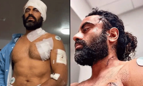 ജോധാഅക്ബര് താരത്തിന് കാലിഫോര്ണിയയിലെ ജിമ്മില് ആക്രമണം ; സിനിമാസ്റ്റൈല് സംഘട്ടനത്തില് ആക്ഷന്ഹീറോ അക്രമിയെ കീഴടക്കി