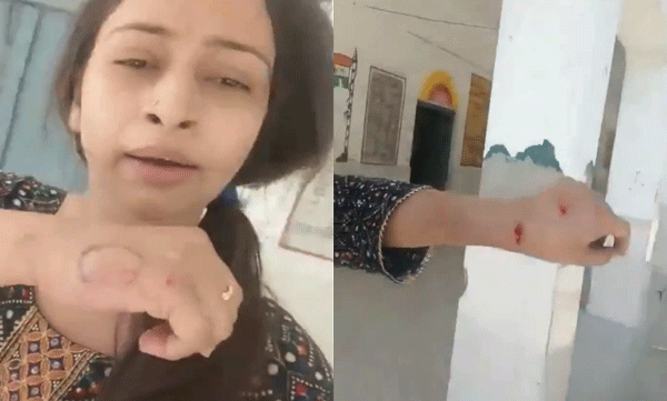 സ്കൂളില് വച്ച് ഫേഷ്യല് മസാജ് ചെയ്യുന്ന വീഡിയോ പകര്ത്തി: അധ്യാപികയെ കടിച്ച് പരിക്കേല്പ്പിച്ച് പ്രിന്സിപ്പള്