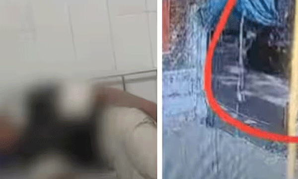 ക്ലാസിൽ സംസാരിച്ചവരുടെ പേര് ബോർഡിലെഴുതി; എട്ടാം ക്ലാസുകാരനെ സഹപാഠിയുടെ പിതാവ് മർദിച്ചു