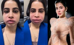 ചുണ്ടുകളും കവിളുകളും വീര്ത്ത വീഡിയോ പങ്കുവെച്ച് ഉര്ഫി; താരത്തിന് ഇതെന്തുപറ്റിയെന്ന് ആരാധകര്