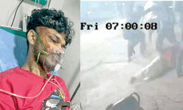പുത്തൂർ ബൈപാസിലെ വാക്കുതർക്കം; സഹോദരന് വേണ്ടി സംസാരിച്ച പ്രവാസി യുവാവിന് ക്രൂരമര്ദനം