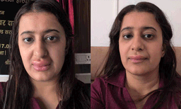 വന്ദേഭാരതിലെ ഭക്ഷണം കഴിച്ചതിന് പിന്നാലെ ചുണ്ടുകള് തടിച്ചുവീര്ത്തു: ഗുരുതര ആരോപണവുമായി യാത്രക്കാരി